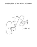 METHODS AND APPARATUS FOR PERFORMING RENAL NEUROMODULATION VIA CATHETER     APPARATUSES HAVING INFLATABLE BALLOONS diagram and image