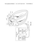 ENHANCED MEDICAL DEVICE FOR USE IN BODILY CAVITIES, FOR EXAMPLE AN ATRIUM diagram and image