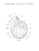 ENHANCED MEDICAL DEVICE FOR USE IN BODILY CAVITIES, FOR EXAMPLE AN ATRIUM diagram and image