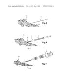 SURGICAL INSTRUMENT FOR A TECHNIQUE FOR ATTACHING BONE FRAGMENTS USING A     CANNULATED SCREW diagram and image