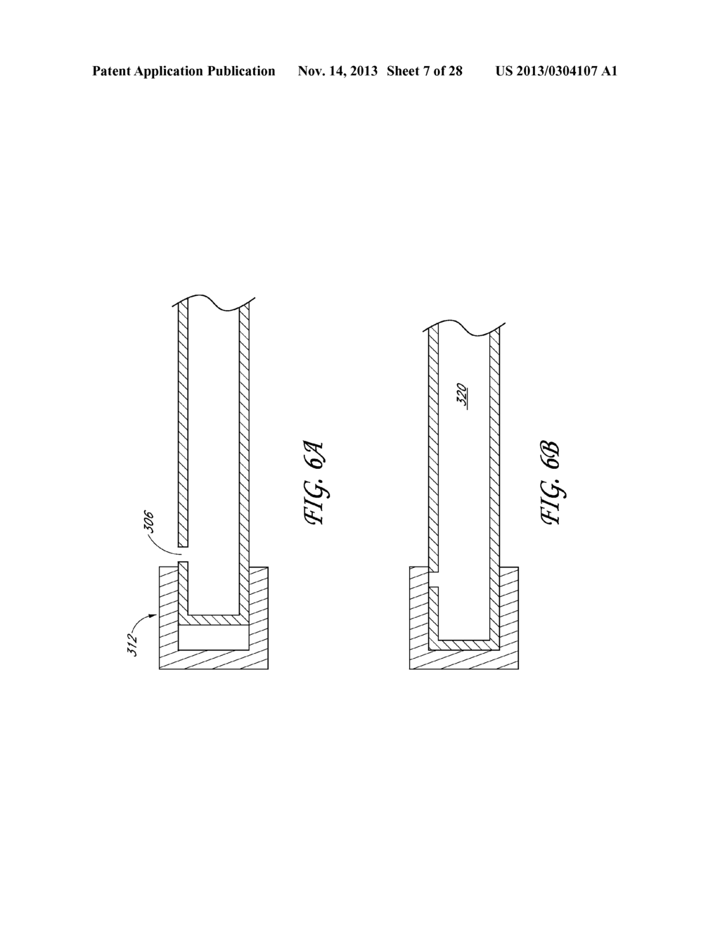 METHOD AND DEVICES FOR FLOW OCCLUSION DURING DEVICE EXCHANGES - diagram, schematic, and image 08