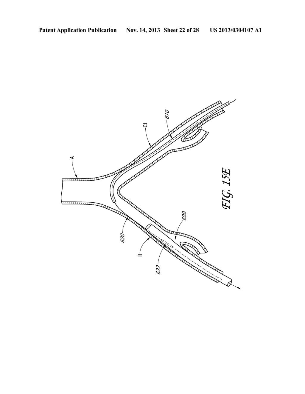 METHOD AND DEVICES FOR FLOW OCCLUSION DURING DEVICE EXCHANGES - diagram, schematic, and image 23