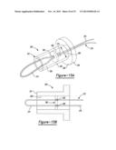 Method And Apparatus For Soft Tissue Attachment diagram and image