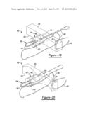 Method And Apparatus For Soft Tissue Attachment diagram and image