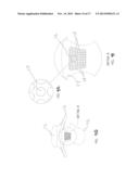 Teething Products diagram and image