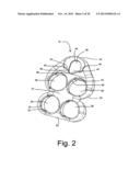 SYSTEM AND METHOD FOR VERTEBRAL BODY PLATING diagram and image