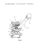 SYSTEM AND METHOD FOR VERTEBRAL BODY PLATING diagram and image