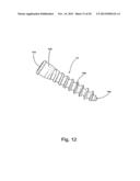 SYSTEM AND METHOD FOR VERTEBRAL BODY PLATING diagram and image