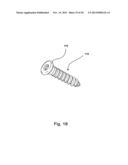 SYSTEM AND METHOD FOR VERTEBRAL BODY PLATING diagram and image