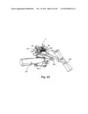 SYSTEM AND METHOD FOR VERTEBRAL BODY PLATING diagram and image