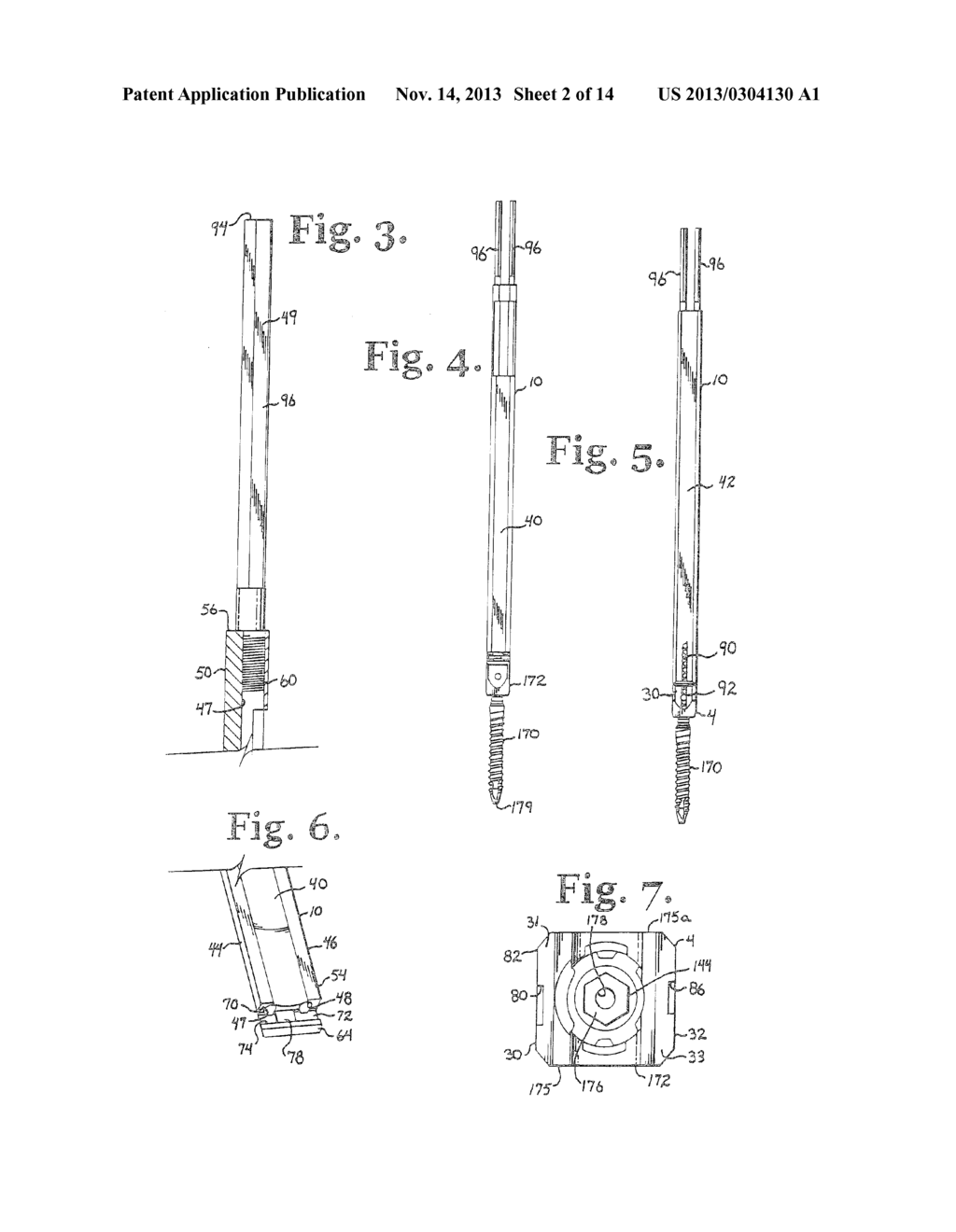 TOOL SYSTEM FOR DYNAMIC SPINAL IMPLANTS - diagram, schematic, and image 03