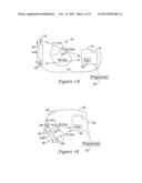 ELECTROMAGNETIC INTERFERENCE SHIELDING IN AN IMPLANTABLE MEDICAL DEVICE diagram and image