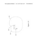 ELECTROMAGNETIC INTERFERENCE SHIELDING IN AN IMPLANTABLE MEDICAL DEVICE diagram and image