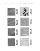 PERIPHERAL NERVE INTERFACE DEVICES FOR TREATMENT AND PREVENTION OF     NEUROMAS diagram and image