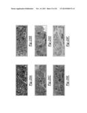 PERIPHERAL NERVE INTERFACE DEVICES FOR TREATMENT AND PREVENTION OF     NEUROMAS diagram and image