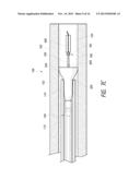 METHODS AND APPARATUS FOR LUMINAL STENTING diagram and image