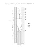 METHODS AND APPARATUS FOR LUMINAL STENTING diagram and image