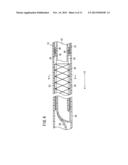 STENT DELIVERY SYSTEM diagram and image