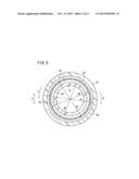 STENT DELIVERY SYSTEM diagram and image