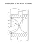 CLOSURE DEVICE diagram and image