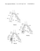 CLOSURE DEVICE diagram and image