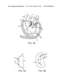 PROSTHETIC HEART VALVE DEVICES, PROSTHETIC MITRAL VALVES AND ASSOCIATED     SYSTEMS AND METHODS diagram and image