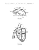 PROSTHETIC HEART VALVE DEVICES, PROSTHETIC MITRAL VALVES AND ASSOCIATED     SYSTEMS AND METHODS diagram and image