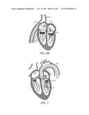 PROSTHETIC HEART VALVE DEVICES, PROSTHETIC MITRAL VALVES AND ASSOCIATED     SYSTEMS AND METHODS diagram and image