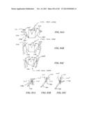 PROSTHETIC HEART VALVE DEVICES, PROSTHETIC MITRAL VALVES AND ASSOCIATED     SYSTEMS AND METHODS diagram and image