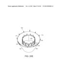 PROSTHETIC HEART VALVE DEVICES, PROSTHETIC MITRAL VALVES AND ASSOCIATED     SYSTEMS AND METHODS diagram and image