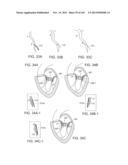 PROSTHETIC HEART VALVE DEVICES, PROSTHETIC MITRAL VALVES AND ASSOCIATED     SYSTEMS AND METHODS diagram and image