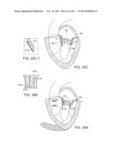 PROSTHETIC HEART VALVE DEVICES, PROSTHETIC MITRAL VALVES AND ASSOCIATED     SYSTEMS AND METHODS diagram and image