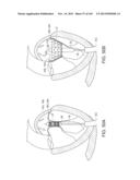 PROSTHETIC HEART VALVE DEVICES, PROSTHETIC MITRAL VALVES AND ASSOCIATED     SYSTEMS AND METHODS diagram and image