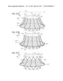 PROSTHETIC HEART VALVE DEVICES, PROSTHETIC MITRAL VALVES AND ASSOCIATED     SYSTEMS AND METHODS diagram and image