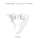 PROSTHETIC HEART VALVE DEVICES, PROSTHETIC MITRAL VALVES AND ASSOCIATED     SYSTEMS AND METHODS diagram and image