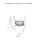 PROSTHETIC HEART VALVE DEVICES, PROSTHETIC MITRAL VALVES AND ASSOCIATED     SYSTEMS AND METHODS diagram and image