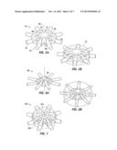 Accommodating Intraocular Lenses diagram and image