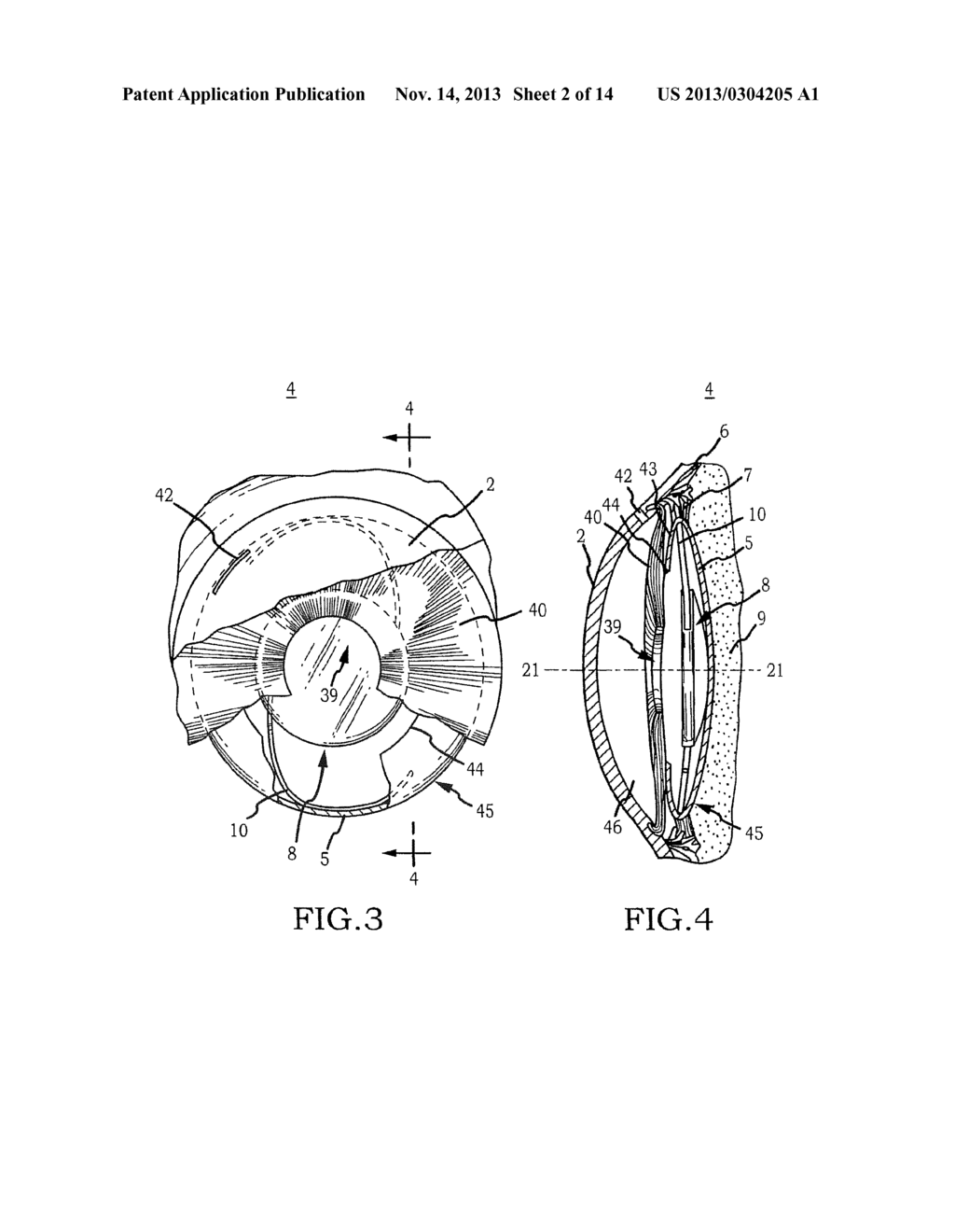 Intraocular Lens Cell Migration Inhibition System - diagram, schematic, and image 03