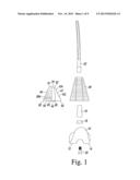 PROSTHESIS KIT WITH FINNED SLEEVE diagram and image