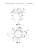 PROSTHESIS KIT WITH FINNED SLEEVE diagram and image