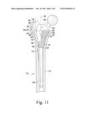 PROSTHESIS KIT WITH FINNED SLEEVE diagram and image