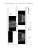 Customization of a Dose Distribution Setting for a Technical Appliance for     Tumour Therapy diagram and image