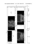 Customization of a Dose Distribution Setting for a Technical Appliance for     Tumour Therapy diagram and image