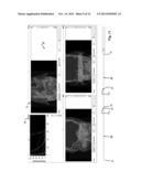 Customization of a Dose Distribution Setting for a Technical Appliance for     Tumour Therapy diagram and image