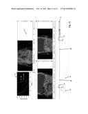 Customization of a Dose Distribution Setting for a Technical Appliance for     Tumour Therapy diagram and image