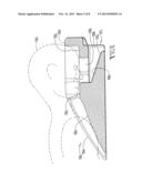 PRONE POSITIONING DEVICE diagram and image