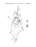 Rotatable Line Tie Arm for a Slotted Lip on a Fishing Lure diagram and image