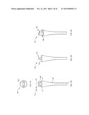 SHOE KIT HAVING REMOVABLE AND INTERCHANGEABLE HEEL ASSEMBLIES diagram and image