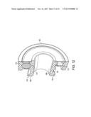 Truck and wheel bearing assembly diagram and image