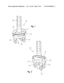 PERIPHERAL PEG DRILL COMPONENT diagram and image